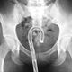 Image for article titled What Did We Get Stuck In Our Rectums Last Year?